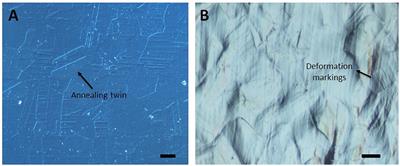 Modulating the Surface Properties of Metallic Implants and the Response of Breast Cancer Cells by Surface Relief Induced via Bulk <mark class="highlighted">Plastic Deformation</mark>